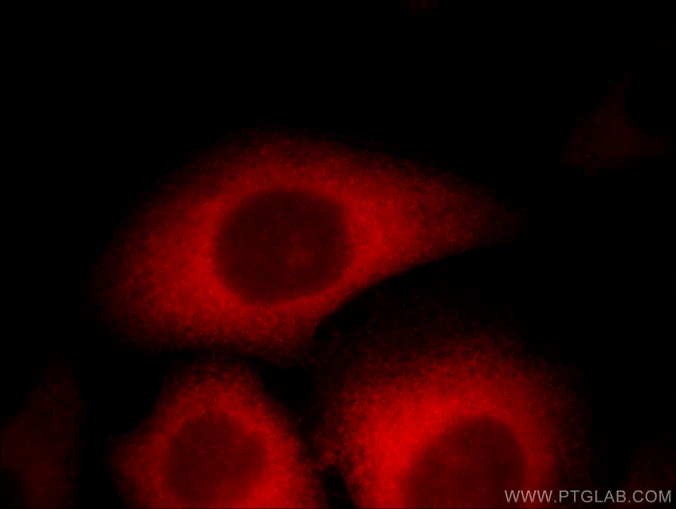 TPD52L2 Immunofluorescence IF 11795-1-AP TPD52L2 Antibody D54; DKFZp686A1765; hD54
