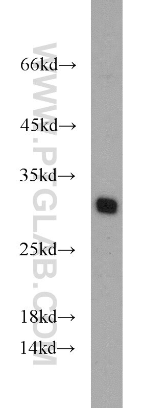 TPD52L2 western blot WB 11795-1-AP TPD52L2 Antibody D54; DKFZp686A1765; hD54