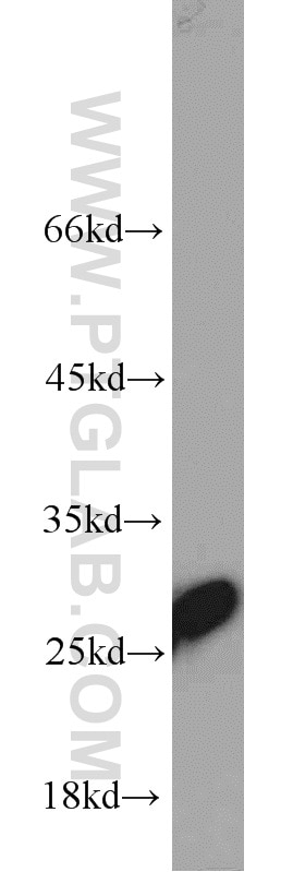 HepG2 cells were subjected to SDS PAGE followed by western blot with 10713-1-AP(TPI1 Antibody) at dilution of 1:2000 TPI1 western blot WB 10713-1-AP TPI1 Antibody MGC88108; TPI