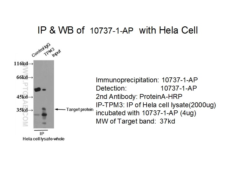 TPM3 IP 10737-1-AP TPM3 Antibody FLJ41118; MGC14582; MGC3261; MGC72094; NEM1; OK/SW-cl.5; TM-5; TM3; TM30; TM30nm; TPMsk3; TRK; hscp30