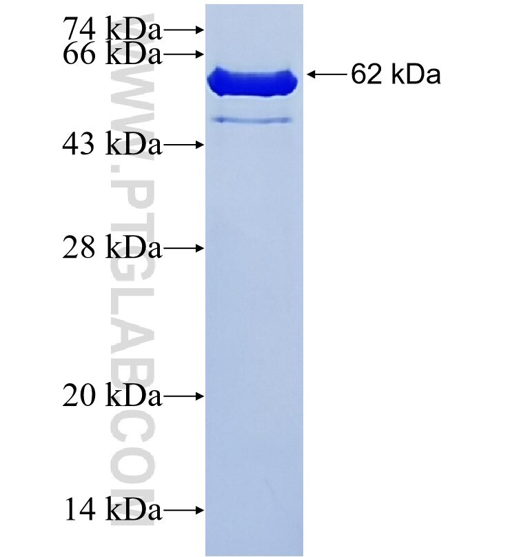 TPM3 fusion protein ag1171 SDS-PAGE