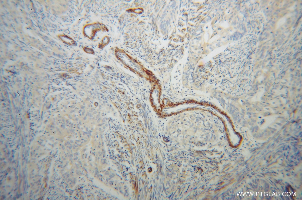 TPM4 IHC Immunohistochemical 13741-1-AP TPM4 Antibody 