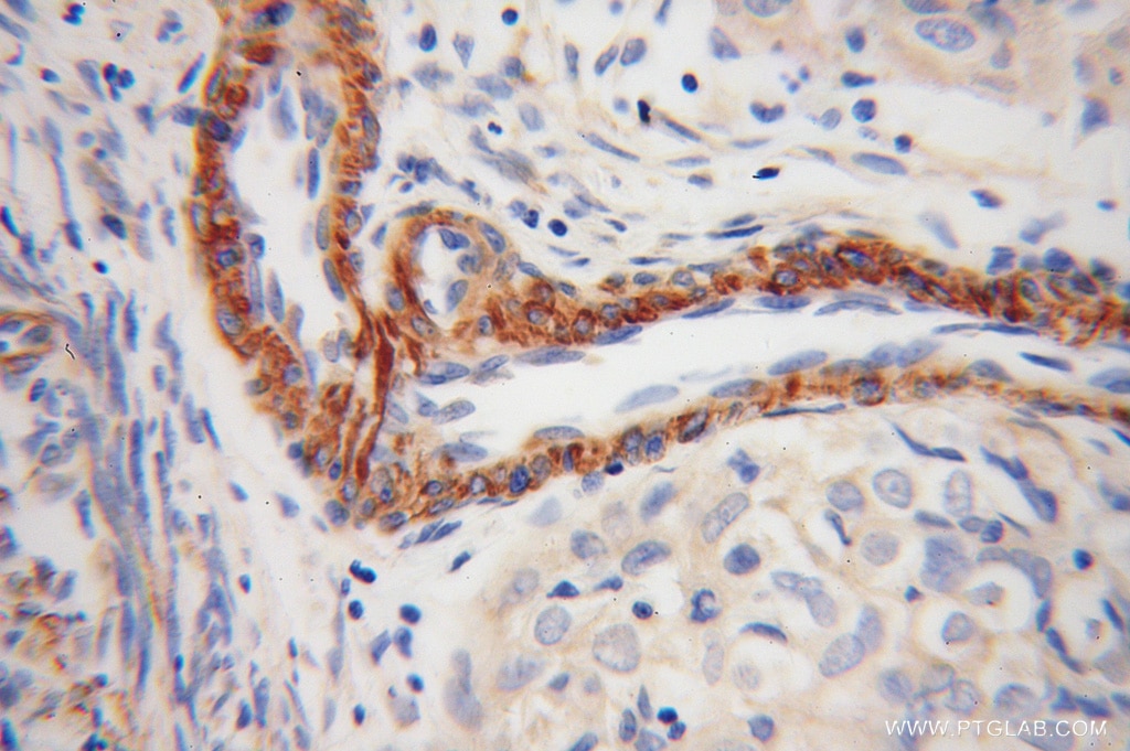 TPM4 IHC Immunohistochemical 13741-1-AP TPM4 Antibody 