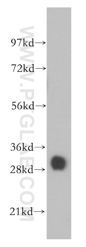 TPM4 western blot WB 13741-1-AP TPM4 Antibody 