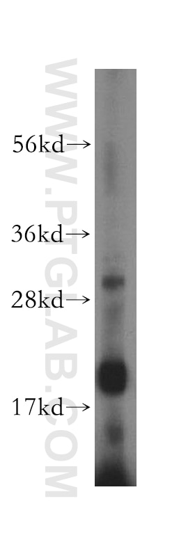 MCF7 cell were subjected to SDS PAGE followed by western blot with 17235-1-AP(TRAIL Antibody) at dilution of 1:1500 TRAIL western blot WB 17235-1-AP TRAIL Antibody TNFSF10;APO2L;Apo-2L;CD253;TL2;TRAIL ;