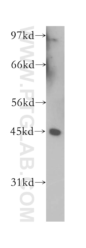 K-562 cells were subjected to SDS PAGE followed by western blot with 12705-1-AP(TRAM1 Antibody) at dilution of 1:1000 TRAM1 western blot WB 12705-1-AP TRAM1 Antibody PNAS-8; PRO1292; TRAM; TRAMP