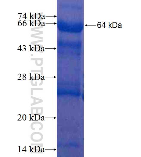 TRAPPC9,NIBP fusion protein ag8791 SDS-PAGE