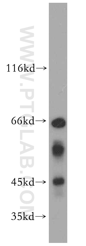 mouse liver tissue were subjected to SDS PAGE followed by western blot with 13300-1-AP(TRIB3 Antibody) at dilution of 1:1000 TRIB3 western blot WB 13300-1-AP TRIB3 Antibody C20orf97; NIPK; SINK; SKIP3; TRB3