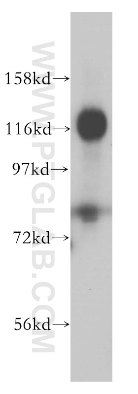TRIM24 western blot WB 14208-1-AP TRIM24 Antibody PTC6; RNF82; TF1A; TIF1; TIF1A; TIF1ALPHA; hTIF1