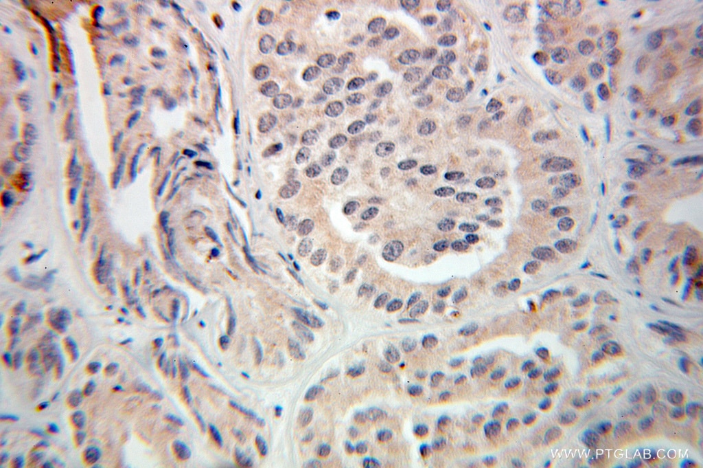TRIM9 IHC Immunohistochemical 10786-1-AP TRIM9 Antibody KIAA0282; RNF91; SPRING