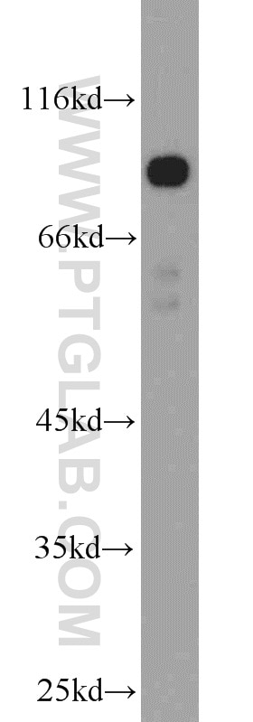 TRIM9 western blot WB 10786-1-AP TRIM9 Antibody KIAA0282; RNF91; SPRING