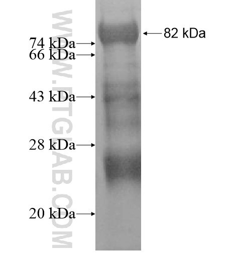 TRMT6 fusion protein ag10176 SDS-PAGE