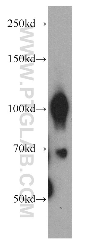 mouse lung tissue were subjected to SDS PAGE followed by western blot with 18236-1-AP(TRPC6 Antibody) at dilution of 1:500 TRPC6 western blot WB 18236-1-AP TRPC6 Antibody FLJ11098; FLJ14863; FSGS2; TRP6