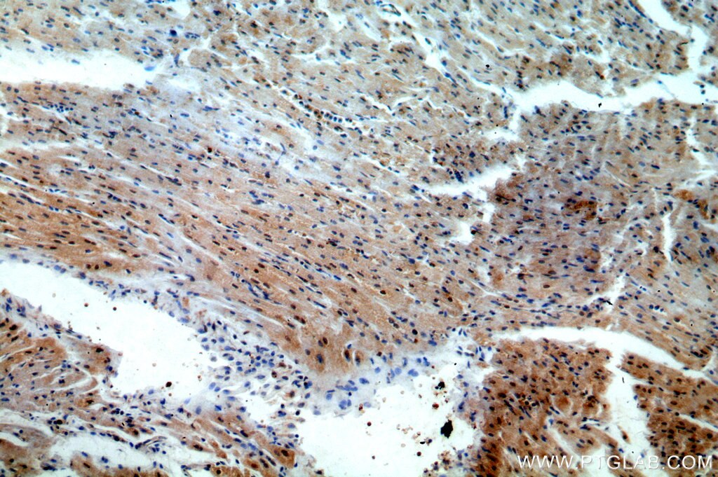 TSG101 IHC Immunohistochemical 14497-1-AP TSG101 Antibody TSG10; VPS23