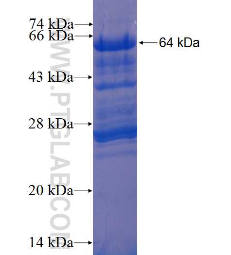 TSHZ1 fusion protein ag2098 SDS-PAGE