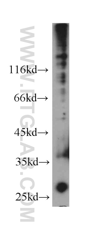 Hela cells were subjected to SDS PAGE followed by western blot with 60049-1-Ig(TSPAN3 Antibody) at dilution of 1:1000 TSPAN3 western blot WB 60049-1-Ig TSPAN3 Antibody TM4-A; TM4SF8; TSPAN-3