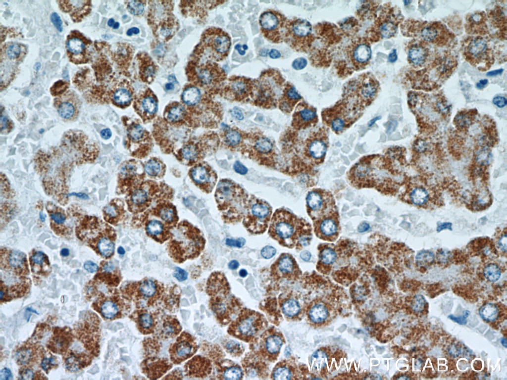TST IHC Immunohistochemical 66018-1-Ig TST Antibody MGC19578; RDS