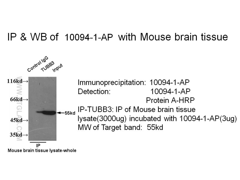 tubulin-beta IP 10094-1-AP tubulin-beta Antibody MC1R; TUBB4; beta-4