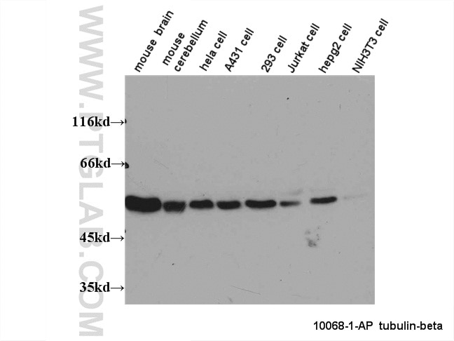 WB results on multiple cells/tissues with anti-Tubulin-beta (10068-1-AP) at dilution 1:1,000. Tubulin-beta western blot WB 10068-1-AP Tubulin-beta Antibody MC1R; TUBB4; beta-4