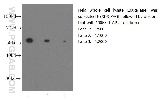 Western blot of Hela cell with anti-Tubulin-Beta (10068-1-AP) at various dilutions. Tubulin-beta western blot WB 10068-1-AP Tubulin-beta Antibody MC1R; TUBB4; beta-4