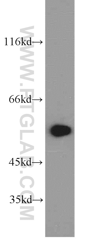 HEK-293 cells were subjected to SDS PAGE followed by western blot with Tubulin-beta Antibody 10068-1-AP Tubulin-beta western blot WB 10068-1-AP Tubulin-beta Antibody MC1R; TUBB4; beta-4