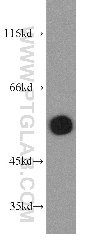 HeLa cells were subjected to SDS PAGE followed by western blot with Tubulin-beta Antibody 10068-1-AP Tubulin-beta western blot WB 10068-1-AP Tubulin-beta Antibody MC1R; TUBB4; beta-4