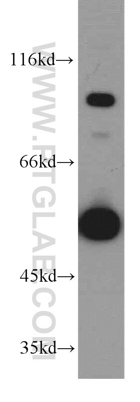 mouse brain tissue were subjected to SDS PAGE followed by western blot with Tubulin-beta Antibody 10068-1-AP Tubulin-beta western blot WB 10068-1-AP Tubulin-beta Antibody MC1R; TUBB4; beta-4