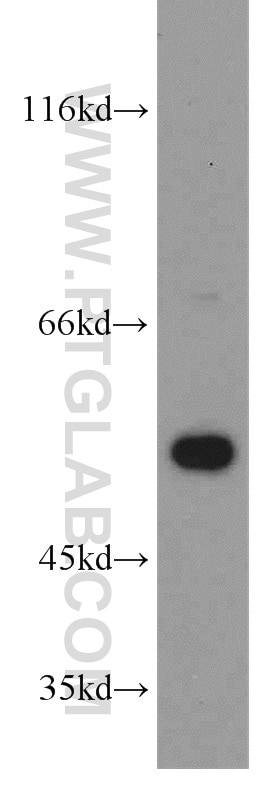 SH-SY5Y cells were subjected to SDS PAGE followed by western blot with Tubulin-beta Antibody 10068-1-AP Tubulin-beta western blot WB 10068-1-AP Tubulin-beta Antibody MC1R; TUBB4; beta-4
