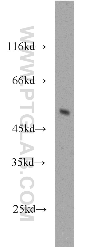 mouse brain tissue were subjected to SDS PAGE followed by western blot with Tubulin-beta Antibody 10068-1-AP Tubulin-beta western blot WB 10068-1-AP Tubulin-beta Antibody MC1R; TUBB4; beta-4