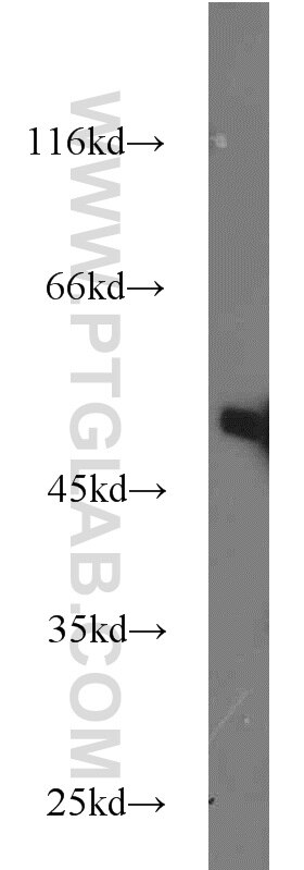 mouse brain tissue were subjected to SDS PAGE followed by western blot with Tubulin-beta Antibody 10068-1-AP Tubulin-beta western blot WB 10068-1-AP Tubulin-beta Antibody MC1R; TUBB4; beta-4