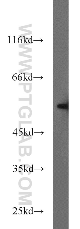 NIH/3T3 cells were subjected to SDS PAGE followed by western blot with Tubulin-beta Antibody 10068-1-AP Tubulin-beta western blot WB 10068-1-AP Tubulin-beta Antibody MC1R; TUBB4; beta-4