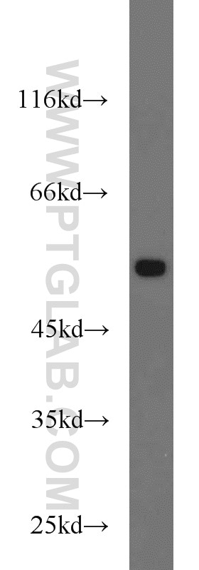 NIH/3T3 cells were subjected to SDS PAGE followed by western blot with Tubulin-beta Antibody 10068-1-AP Tubulin-beta western blot WB 10068-1-AP Tubulin-beta Antibody MC1R; TUBB4; beta-4
