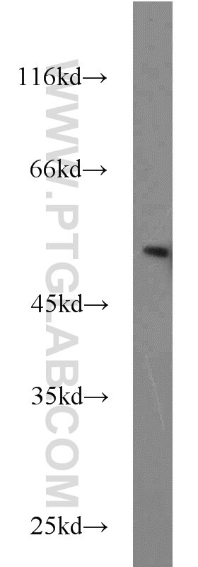 Jurkat cells were subjected to SDS PAGE followed by western blot with Tubulin-beta Antibody 10068-1-AP Tubulin-beta western blot WB 10068-1-AP Tubulin-beta Antibody MC1R; TUBB4; beta-4