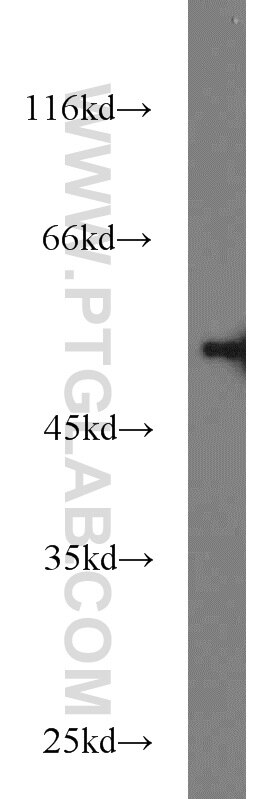 A431 cells were subjected to SDS PAGE followed by western blot with Tubulin-beta Antibody 10068-1-AP Tubulin-beta western blot WB 10068-1-AP Tubulin-beta Antibody MC1R; TUBB4; beta-4