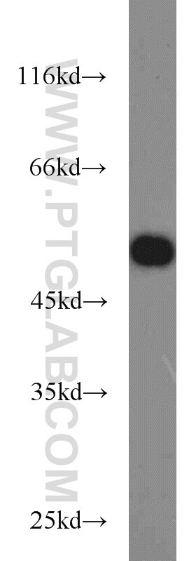 A431 cells were subjected to SDS PAGE followed by western blot with Tubulin-beta Antibody 10068-1-AP Tubulin-beta western blot WB 10068-1-AP Tubulin-beta Antibody MC1R; TUBB4; beta-4