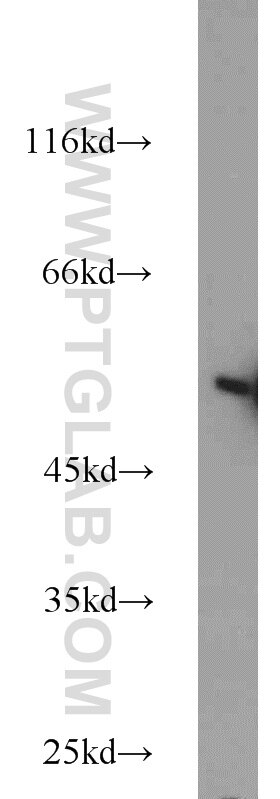 HepG2 cells were subjected to SDS PAGE followed by western blot with Tubulin-beta Antibody 10068-1-AP Tubulin-beta western blot WB 10068-1-AP Tubulin-beta Antibody MC1R; TUBB4; beta-4
