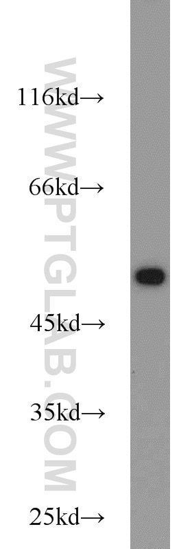 HepG2 cells were subjected to SDS PAGE followed by western blot with Tubulin-beta Antibody 10068-1-AP Tubulin-beta western blot WB 10068-1-AP Tubulin-beta Antibody MC1R; TUBB4; beta-4