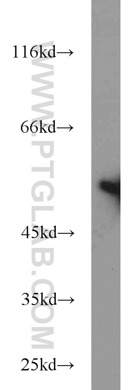 HeLa cells were subjected to SDS PAGE followed by western blot with Tubulin-beta Antibody 10068-1-AP Tubulin-beta western blot WB 10068-1-AP Tubulin-beta Antibody MC1R; TUBB4; beta-4