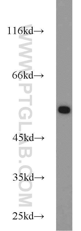 HeLa cells were subjected to SDS PAGE followed by western blot with Tubulin-beta Antibody 10068-1-AP Tubulin-beta western blot WB 10068-1-AP Tubulin-beta Antibody MC1R; TUBB4; beta-4