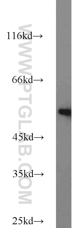 A431 cells were subjected to SDS PAGE followed by western blot with Tubulin-beta Antibody 10068-1-AP Tubulin-beta western blot WB 10068-1-AP Tubulin-beta Antibody MC1R; TUBB4; beta-4