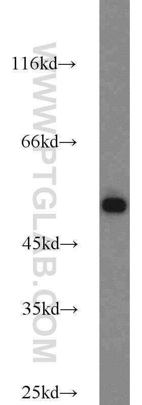 A431 cells were subjected to SDS PAGE followed by western blot with Tubulin-beta Antibody 10068-1-AP Tubulin-beta western blot WB 10068-1-AP Tubulin-beta Antibody MC1R; TUBB4; beta-4