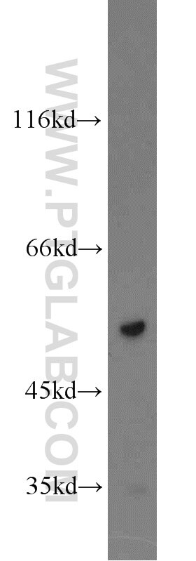 mouse colon tissue were subjected to SDS PAGE followed by western blot with Tubulin-beta Antibody 10068-1-AP Tubulin-beta western blot WB 10068-1-AP Tubulin-beta Antibody MC1R; TUBB4; beta-4