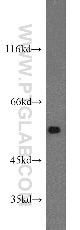 COLO 320 cells were subjected to SDS PAGE followed by western blot with Tubulin-beta Antibody 10068-1-AP Tubulin-beta western blot WB 10068-1-AP Tubulin-beta Antibody MC1R; TUBB4; beta-4