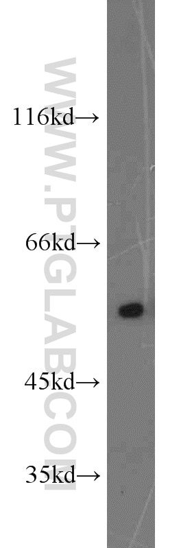 COLO 320 cells were subjected to SDS PAGE followed by western blot with Tubulin-beta Antibody 10068-1-AP Tubulin-beta western blot WB 10068-1-AP Tubulin-beta Antibody MC1R; TUBB4; beta-4