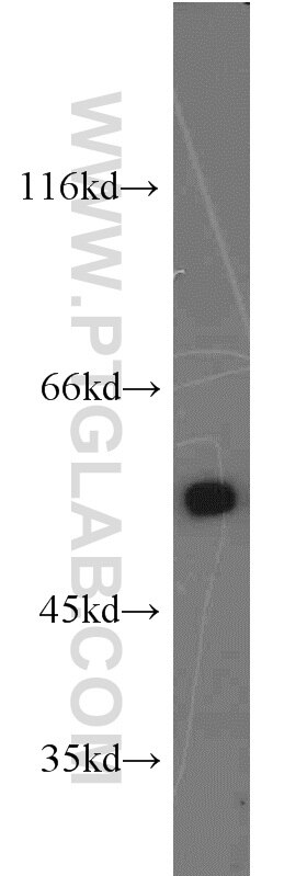 COLO 320 cells were subjected to SDS PAGE followed by western blot with Tubulin-beta Antibody 10068-1-AP Tubulin-beta western blot WB 10068-1-AP Tubulin-beta Antibody MC1R; TUBB4; beta-4