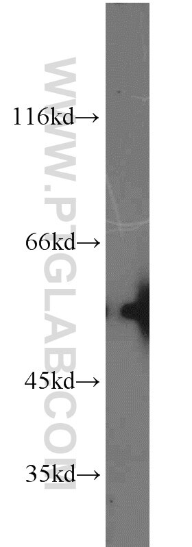 COLO 320 cells were subjected to SDS PAGE followed by western blot with Tubulin-beta Antibody 10068-1-AP Tubulin-beta western blot WB 10068-1-AP Tubulin-beta Antibody MC1R; TUBB4; beta-4