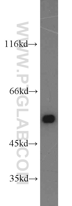COLO 320 cells were subjected to SDS PAGE followed by western blot with Tubulin-beta Antibody 10068-1-AP Tubulin-beta western blot WB 10068-1-AP Tubulin-beta Antibody MC1R; TUBB4; beta-4