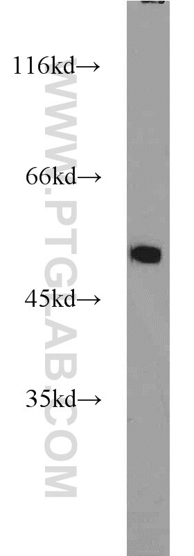 HepG2 cells were subjected to SDS PAGE followed by western blot with Tubulin-beta Antibody 10068-1-AP Tubulin-beta western blot WB 10068-1-AP Tubulin-beta Antibody MC1R; TUBB4; beta-4