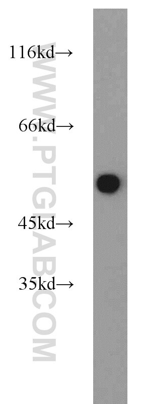 Jurkat cells were subjected to SDS PAGE followed by western blot with Tubulin-beta Antibody 10068-1-AP Tubulin-beta western blot WB 10068-1-AP Tubulin-beta Antibody MC1R; TUBB4; beta-4