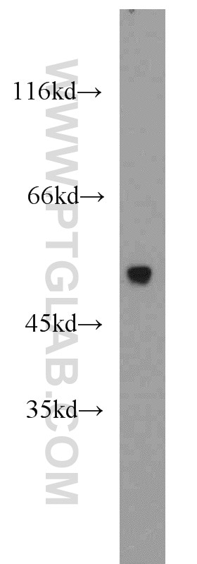 A431 cells were subjected to SDS PAGE followed by western blot with Tubulin-beta Antibody 10068-1-AP Tubulin-beta western blot WB 10068-1-AP Tubulin-beta Antibody MC1R; TUBB4; beta-4